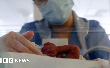 Epidural kit shortage could last until March, regulator says