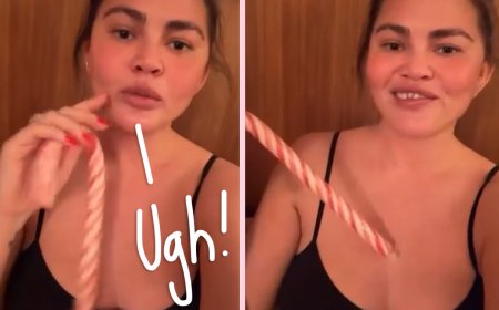 Chrissy Teigen Is Toothless Now -- LOOK!