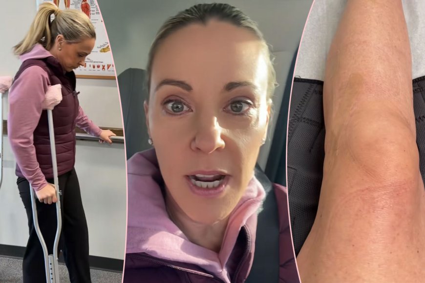 Kate Gosselin Shares Update Months After ‘Life-Altering’ Leg Injury Left Her Unable To Walk!