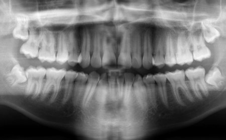 Regrowing Teeth Might Not Be Science Fiction Anymore