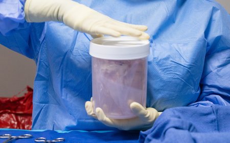 Increased Scrutiny Leads to an Improved Organ Transplant System