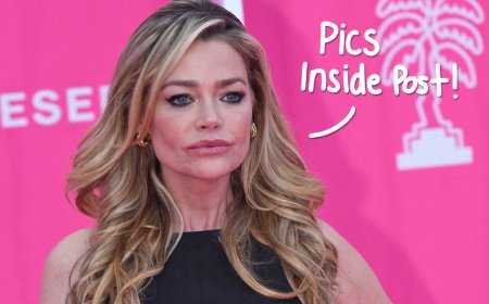 Denise Richards Debuts Transformative Facelift! See The Before-And-After Photos!
