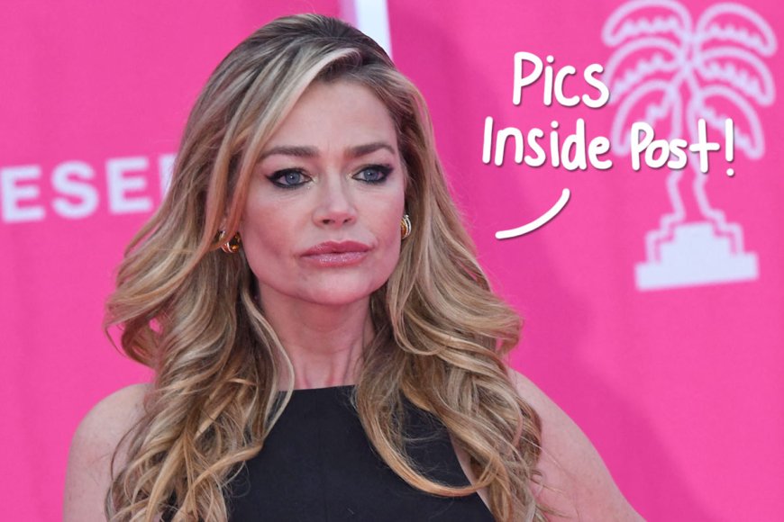 Denise Richards Debuts Transformative Facelift! See The Before-And-After Photos!