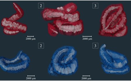 Earthworms Don’t Bio-Accumulate Microplastics, So There May be Hope For Us