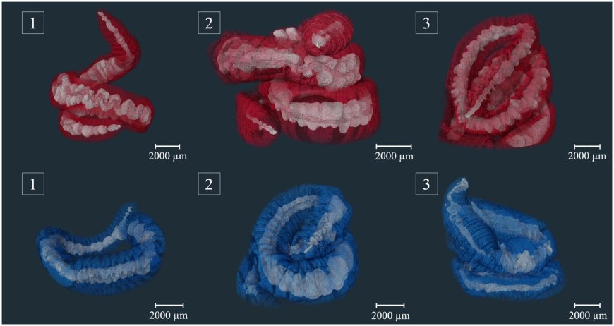 Earthworms Don’t Bio-Accumulate Microplastics, So There May be Hope For Us